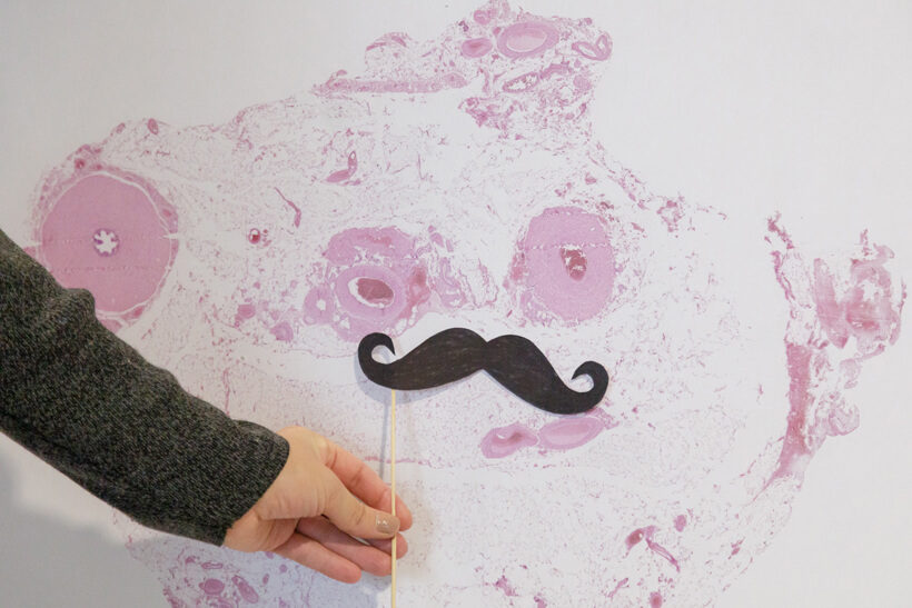 A unique exhibition at MUW as part of the Movember campaign