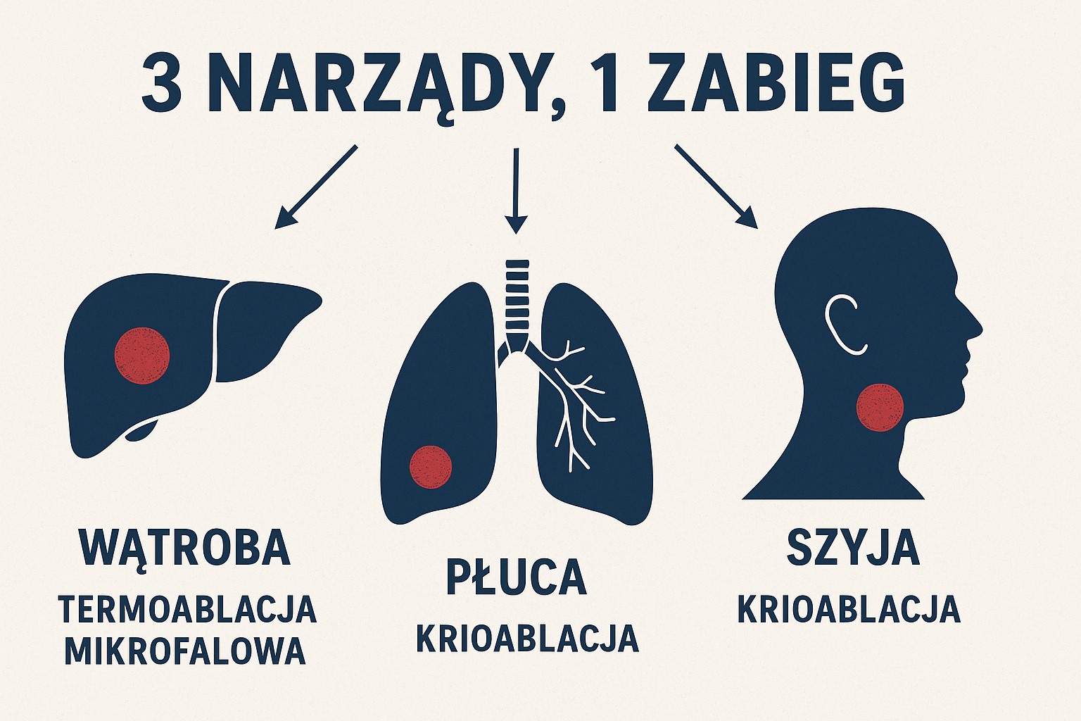 The graphic is titled “Three organs, one procedure.”  Below, under the title, are three illustrations: liver, lungs and neck, each with a red dot indicating the place of the procedure. Under the liver is the caption 'Liver microwave thermoablation', under the lungs is 'Lungs cryoablation', and under the neck is 'Neck cryoablation'.