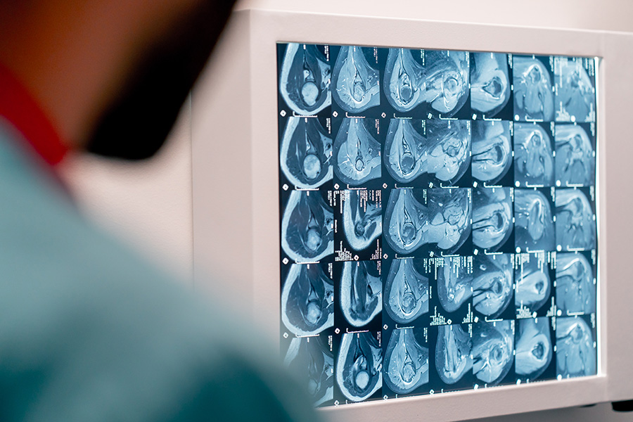 A computer screen displaying an image of an organ or tissue, next to the outline of a seated person viewing it.