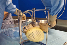 Poland's first new generation artificial heart