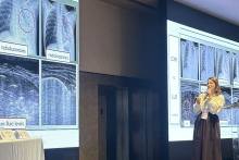 Kobieta prezentuje slajd z obrazami RTG i USG klatki piersiowej z zaznaczonymi zmianami.