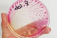 Dłoń w rękawiczce trzyma szalkę Petriego z różowym podłożem. Na powierzchni widać liczne kolonie bakterii w odcieniach różu i fioletu, ułożone w liniach rozchodzących się promieniście. Na górze szalki widnieje czarny napis „3”. 